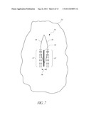 METHODS OF LIGHT TREATMENT OF WOUNDS TO REDUCE SCAR FORMATION diagram and image