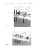 Bone Distraction System diagram and image