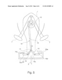 INSERTION DEVICE diagram and image