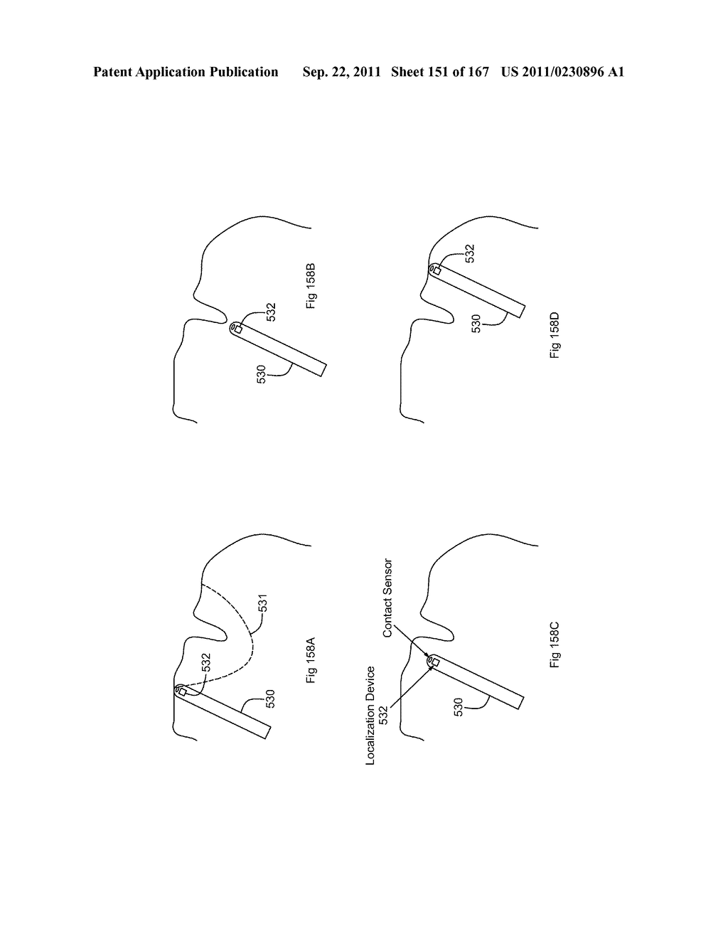 ROBOTIC CATHETER SYSTEM - diagram, schematic, and image 152