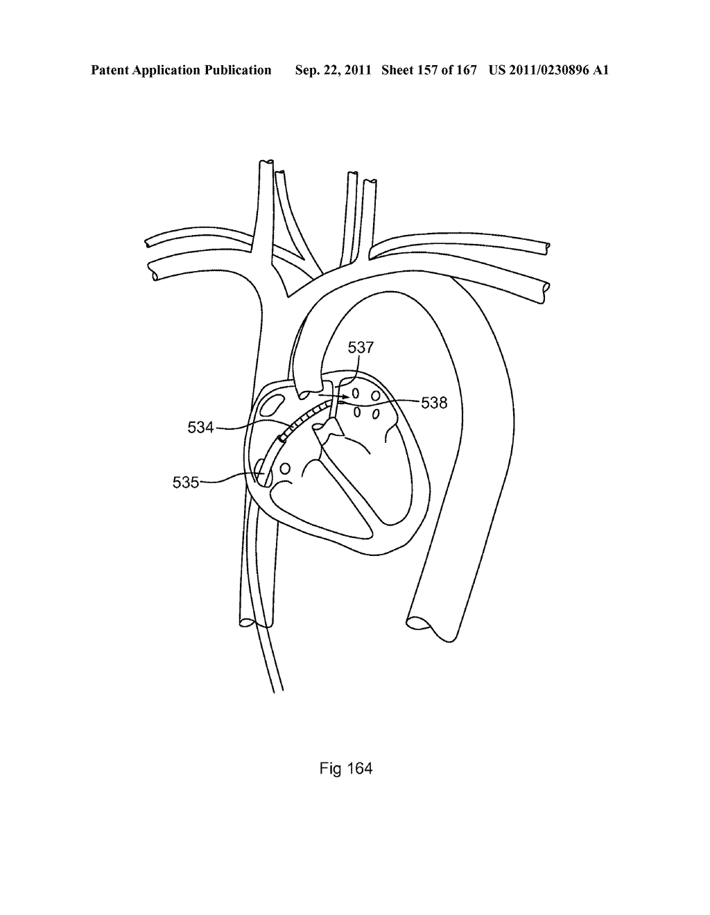 ROBOTIC CATHETER SYSTEM - diagram, schematic, and image 158