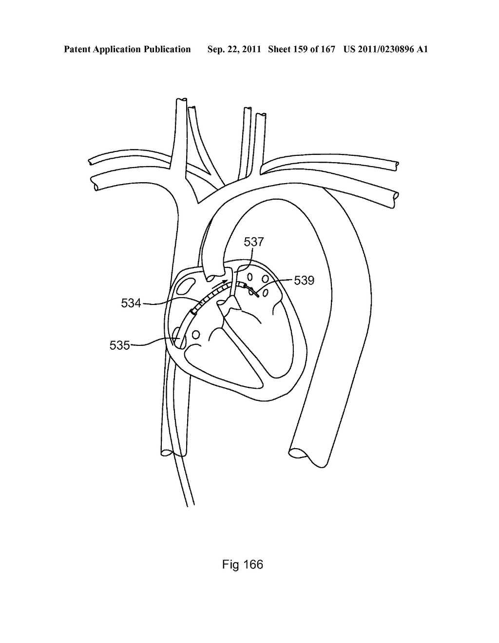 ROBOTIC CATHETER SYSTEM - diagram, schematic, and image 160