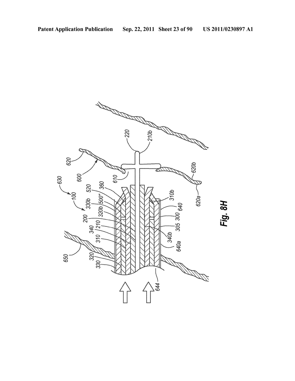 CLIP APPLIER AND METHODS OF USE - diagram, schematic, and image 25