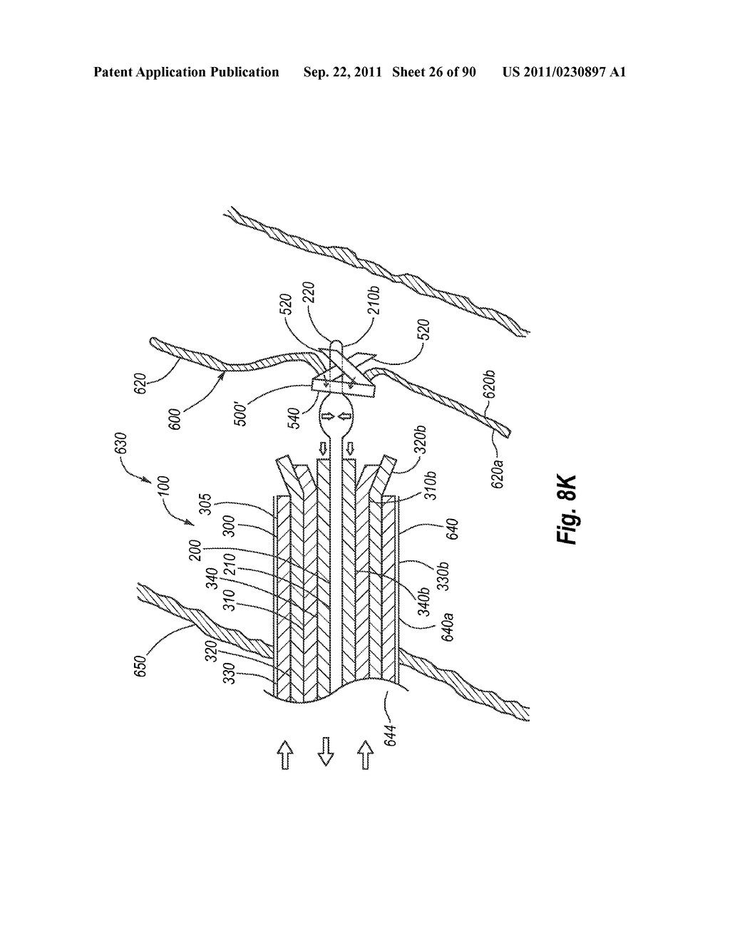 CLIP APPLIER AND METHODS OF USE - diagram, schematic, and image 28