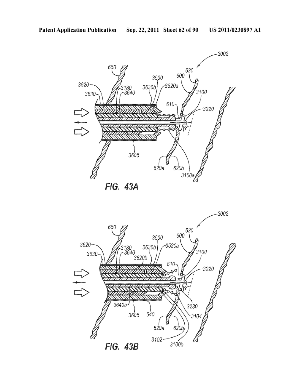 CLIP APPLIER AND METHODS OF USE - diagram, schematic, and image 64