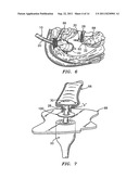 SUPPORT STRUCTURES AND METHODS OF USING THE SAME diagram and image