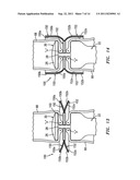 SUPPORT STRUCTURES AND METHODS OF USING THE SAME diagram and image