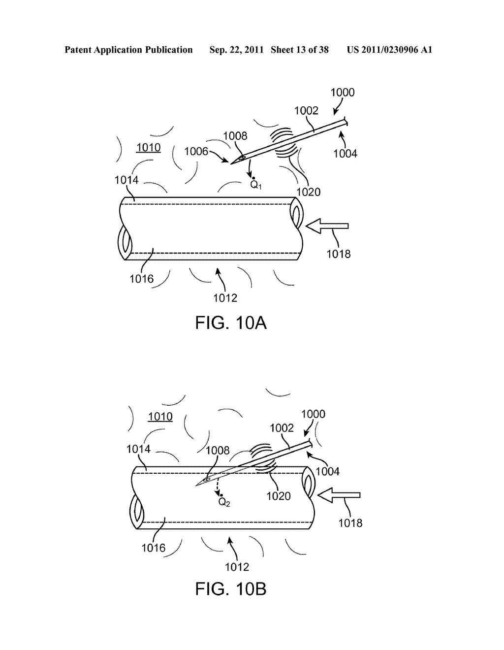 DEVICES, METHODS AND KITS FOR FORMING TRACTS IN TISSUE - diagram, schematic, and image 14