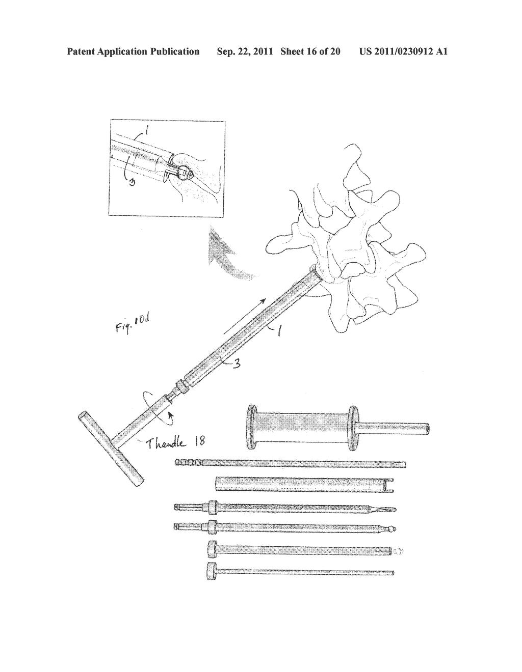 CORTICAL, ANTI-MIGRATION, FACET DOWEL FOR FUSION OF FACET JOINTS IN THE     SPINE AND DEVICES FOR SETTING THE SAME IN PLACE - diagram, schematic, and image 17