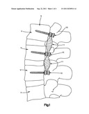 DYNAMIC CABLE SYSTEM diagram and image