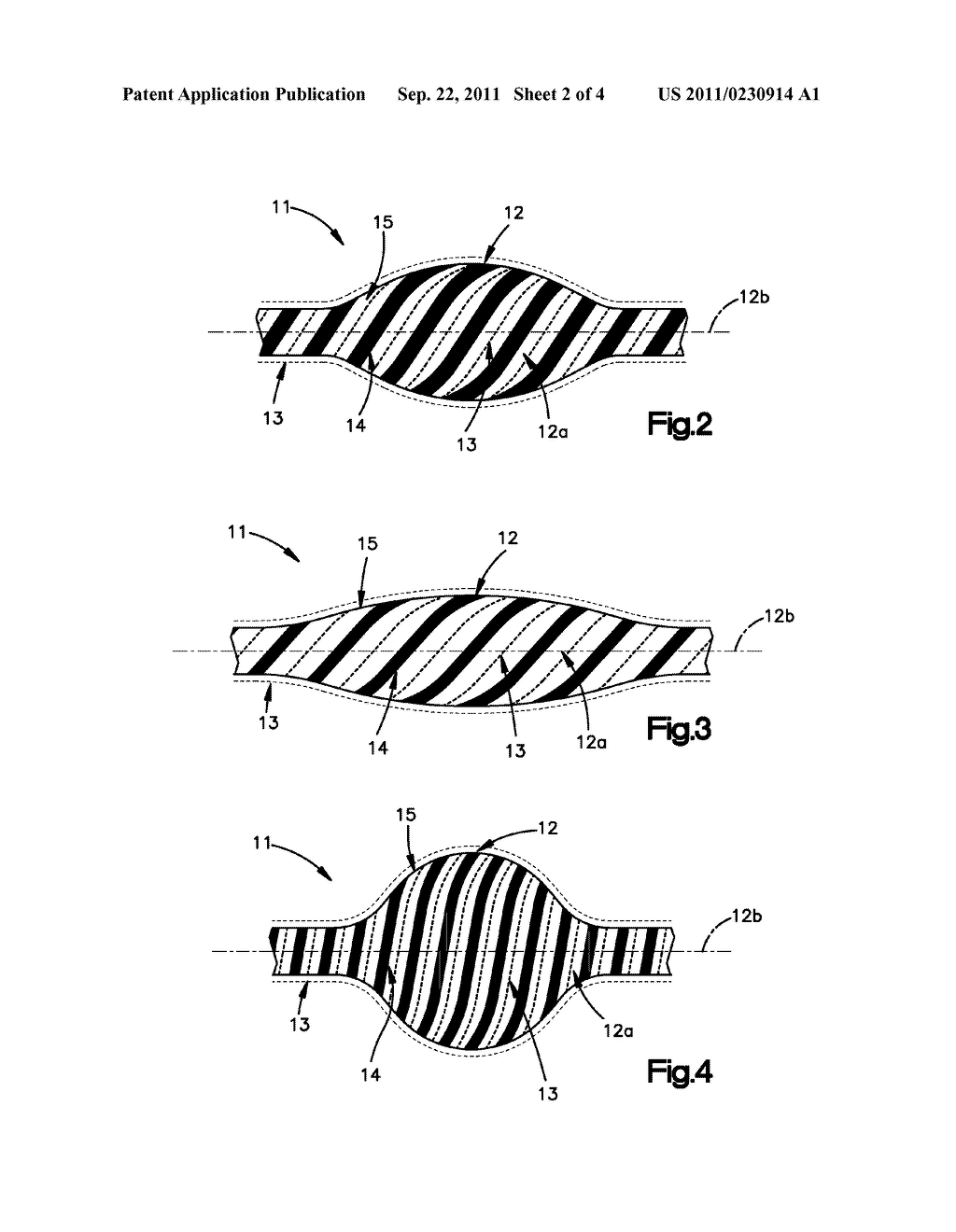 DYNAMIC CABLE SYSTEM - diagram, schematic, and image 03