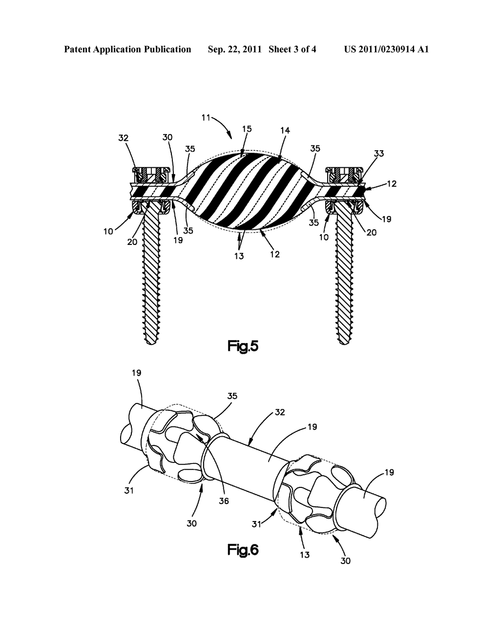 DYNAMIC CABLE SYSTEM - diagram, schematic, and image 04