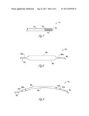 METHOD AND APPARATUS FOR PACING DURING REVASCULARIZATION diagram and image