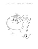 IMPLANTABLE LEAD FOR AN ACTIVE MEDICAL DEVICE HAVING AN INDUCTOR DESIGN     MINIMIZING EDDY CURRENT LOSSES diagram and image