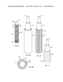 IMPLANTABLE LEAD FOR AN ACTIVE MEDICAL DEVICE HAVING AN INDUCTOR DESIGN     MINIMIZING EDDY CURRENT LOSSES diagram and image