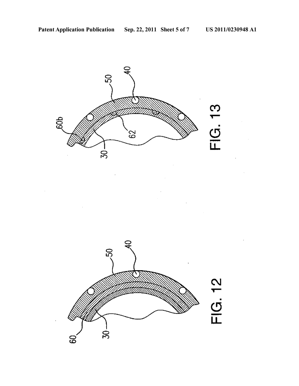 STENT DELIVERY SYSTEM HAVING A FIBROUS MATRIX COVERING WITH IMPROVED STENT     RETENTION - diagram, schematic, and image 06