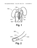 ENDOPROSTHESIS ASSEMBLIES AND METHODS FOR USING THE SAME diagram and image