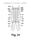 ENDOPROSTHESIS ASSEMBLIES AND METHODS FOR USING THE SAME diagram and image