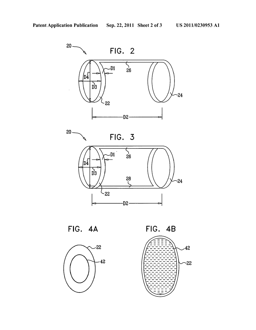 ELLIPTICAL ELEMENT FOR BLOOD PRESSURE REDUCTION - diagram, schematic, and image 03