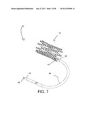 REPOSITIONABLE ENDOLUMINAL SUPPORT STRUCTURE AND ITS APPLICATIONS diagram and image