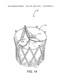 REPOSITIONABLE ENDOLUMINAL SUPPORT STRUCTURE AND ITS APPLICATIONS diagram and image