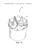 REPOSITIONABLE ENDOLUMINAL SUPPORT STRUCTURE AND ITS APPLICATIONS diagram and image