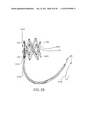 REPOSITIONABLE ENDOLUMINAL SUPPORT STRUCTURE AND ITS APPLICATIONS diagram and image