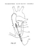 REPOSITIONABLE ENDOLUMINAL SUPPORT STRUCTURE AND ITS APPLICATIONS diagram and image