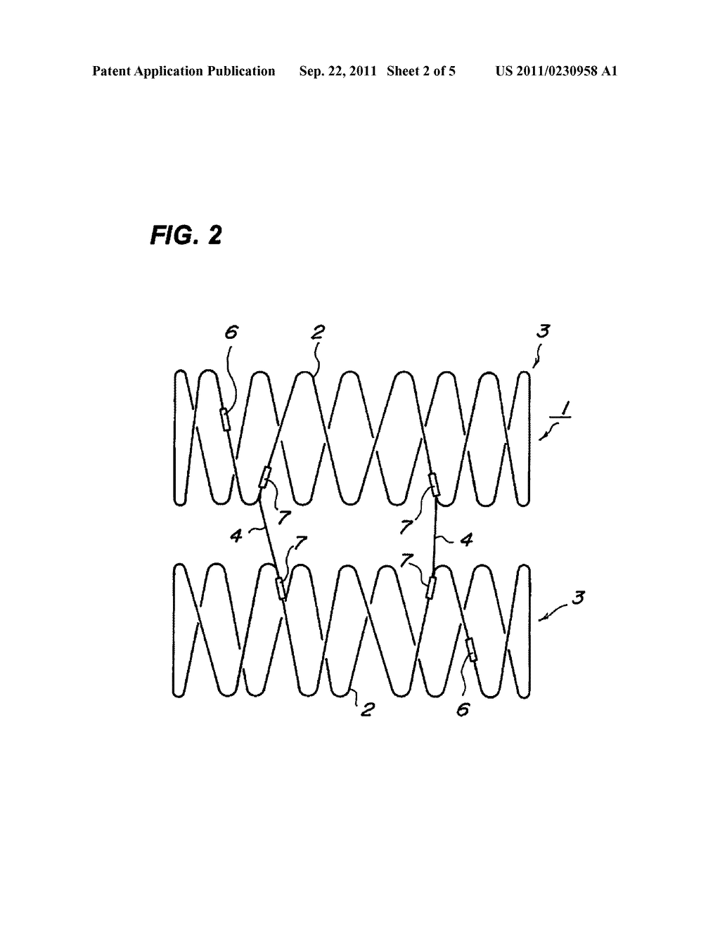 Stent - diagram, schematic, and image 03