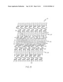 Stent with Protruding Branch Portion for Bifurcated Vessels diagram and image