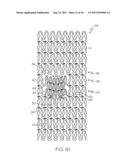 Stent with Protruding Branch Portion for Bifurcated Vessels diagram and image