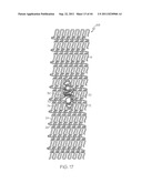 Stent with Protruding Branch Portion for Bifurcated Vessels diagram and image