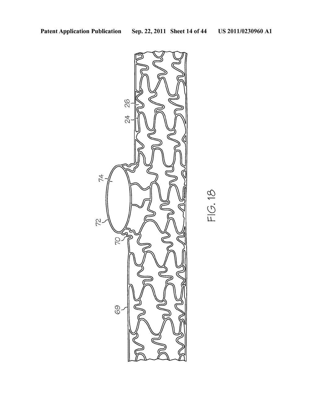 Stent with Protruding Branch Portion for Bifurcated Vessels - diagram, schematic, and image 15