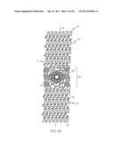 Stent with Protruding Branch Portion for Bifurcated Vessels diagram and image