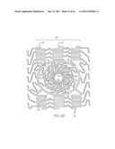 Stent with Protruding Branch Portion for Bifurcated Vessels diagram and image