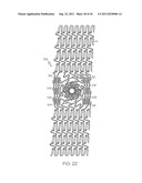 Stent with Protruding Branch Portion for Bifurcated Vessels diagram and image