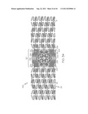 Stent with Protruding Branch Portion for Bifurcated Vessels diagram and image