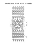 Stent with Protruding Branch Portion for Bifurcated Vessels diagram and image