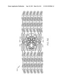 Stent with Protruding Branch Portion for Bifurcated Vessels diagram and image