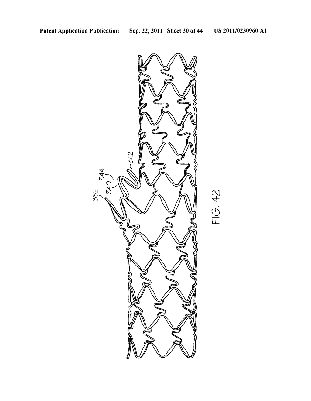 Stent with Protruding Branch Portion for Bifurcated Vessels - diagram, schematic, and image 31