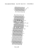 Stent with Protruding Branch Portion for Bifurcated Vessels diagram and image