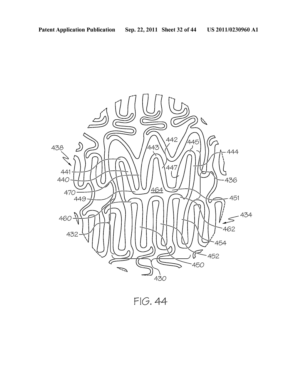 Stent with Protruding Branch Portion for Bifurcated Vessels - diagram, schematic, and image 33