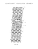 Stent with Protruding Branch Portion for Bifurcated Vessels diagram and image