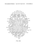 Stent with Protruding Branch Portion for Bifurcated Vessels diagram and image