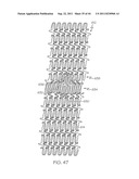 Stent with Protruding Branch Portion for Bifurcated Vessels diagram and image