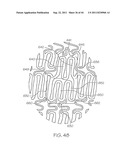 Stent with Protruding Branch Portion for Bifurcated Vessels diagram and image