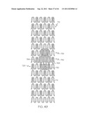 Stent with Protruding Branch Portion for Bifurcated Vessels diagram and image