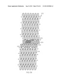 Stent with Protruding Branch Portion for Bifurcated Vessels diagram and image