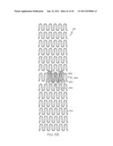 Stent with Protruding Branch Portion for Bifurcated Vessels diagram and image