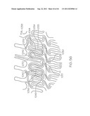 Stent with Protruding Branch Portion for Bifurcated Vessels diagram and image